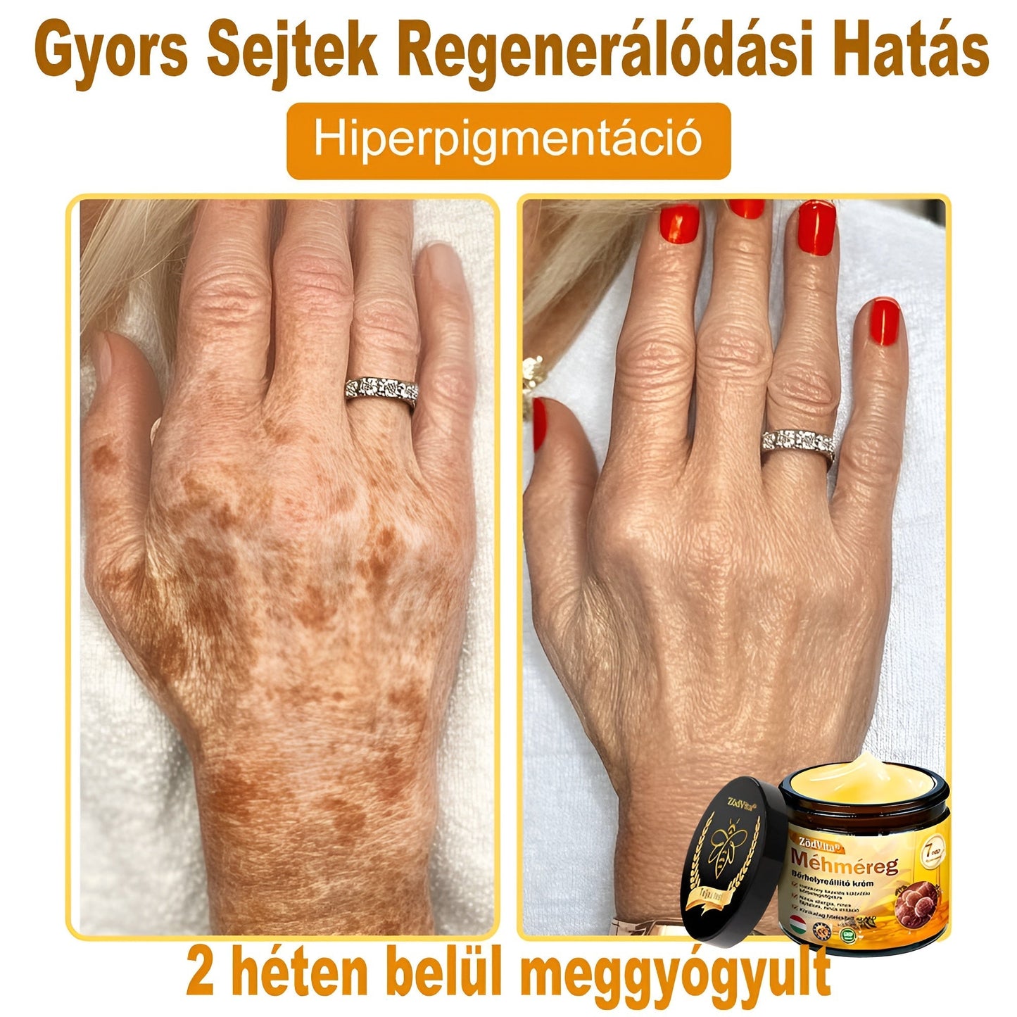 🎁Bőrgyógyász ajánlása 🐝 ZödVita® Méhmérges Regeneráló Krém 🔥 Ráncok, pigmentfoltok és megereszkedett bőr ellen – 50 ml
