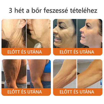 🧑‍⚕️Bőrgyógyász ajánlása 🐝 ZödVita® Méhmérges Regeneráló Krém 🔥 Ráncok, pigmentfoltok és megereszkedett bőr ellen – 50 ml🔥