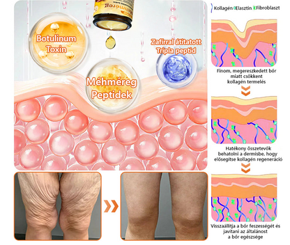 🧑‍⚕️Bőrgyógyász ajánlása 🐝 ZödVita® Méhmérges Regeneráló Krém 🔥 Ráncok, pigmentfoltok és megereszkedett bőr ellen – 50 ml🔥