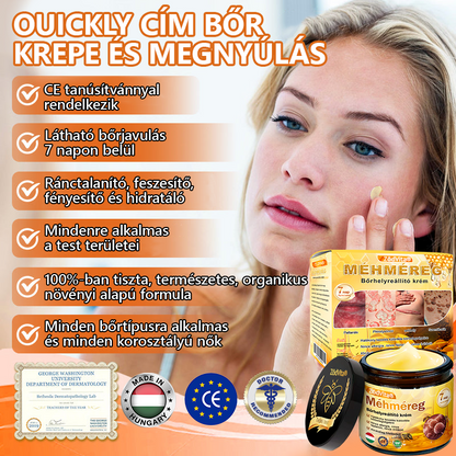 🧑‍⚕️Bőrgyógyász ajánlása 🐝 ZödVita® Méhmérges Regeneráló Krém 🔥 Ráncok, pigmentfoltok és megereszkedett bőr ellen – 50 ml🔥