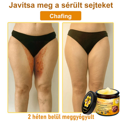 (👨‍⚕‍Bőrgyógyász ajánlása) ✨𝐏𝐮𝐫𝐚𝐂𝐮𝐫𝐞® Méhmérges Bőrmegújító Krém Ráncok,Természetes összetevők, amelyek tartósan eltávolítják a plamokat, szeplőket és napfoltokat, valamint harcolnak a ráncok és megereszkedett bőr ellen — 50 ml👍