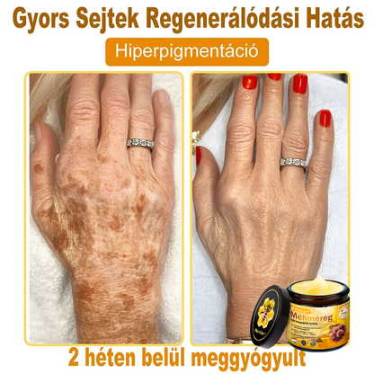 (👨‍⚕‍Bőrgyógyász ajánlása) ✨𝐏𝐮𝐫𝐚𝐂𝐮𝐫𝐞® Méhmérges Bőrmegújító Krém Ráncok,Természetes összetevők, amelyek tartósan eltávolítják a plamokat, szeplőket és napfoltokat, valamint harcolnak a ráncok és megereszkedett bőr ellen — 50 ml👍