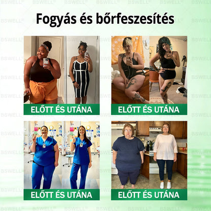 🍃BSWELL® Nano mikrotűs karcsúsító tapasz (Naponta egyszer már 28 napon belül látható változások láthatók) Alkalmas: elhízás kezelésére, szív- és érrendszeri egészségre, cukorbetegség kezelésére, alvási apnoéra és bélrendszeri problémákr🍃🍃