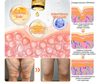 (👨‍⚕‍Bőrgyógyász ajánlása) ✨𝐏𝐮𝐫𝐚𝐂𝐮𝐫𝐞® Méhmérges Bőrmegújító Krém Ráncok,Természetes összetevők, amelyek tartósan eltávolítják a plamokat, szeplőket és napfoltokat, valamint harcolnak a ráncok és megereszkedett bőr ellen — 50 ml👍