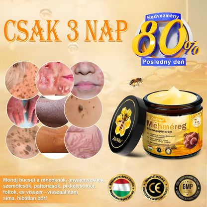 Bőrgyógyász ajánlása 🔥✨ ZödVita® Méhméreg Bőr Helyreállító Krém 🔥 Magyar fejlesztés, magyarországi gyártás és szállítás