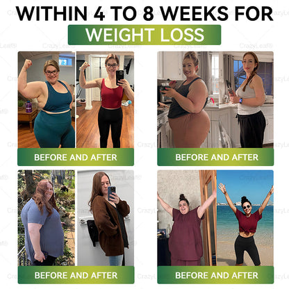 🎁AU Clinically Proven|Official Store | CrazyLeaf® SMGT-GLP-1 Nano Microneedle Patch with Collagen & Matrixyl 3000 丨Targets Obesity, Loose Skin, High Blood Pressure, Diabetes, Fatty Liver, Joint Pain, Brain Fog, Low Energy, Body Aches, and More