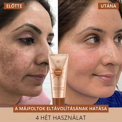 𝐅𝐑𝐈𝐒𝐒𝐀𝐑𝐂™ Fehérítő És Folteltávolító Arcmaszk | Természetes összetevők tartósan eltüntetik a foltokat, szeplőket és napfoltokat