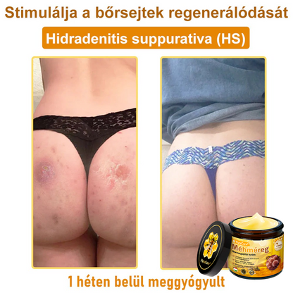 (👨‍⚕‍Bőrgyógyász ajánlása) ✨𝐏𝐮𝐫𝐚𝐂𝐮𝐫𝐞® Méhmérges Bőrmegújító Krém Ráncok,Természetes összetevők, amelyek tartósan eltávolítják a plamokat, szeplőket és napfoltokat, valamint harcolnak a ráncok és megereszkedett bőr ellen — 50 ml👍