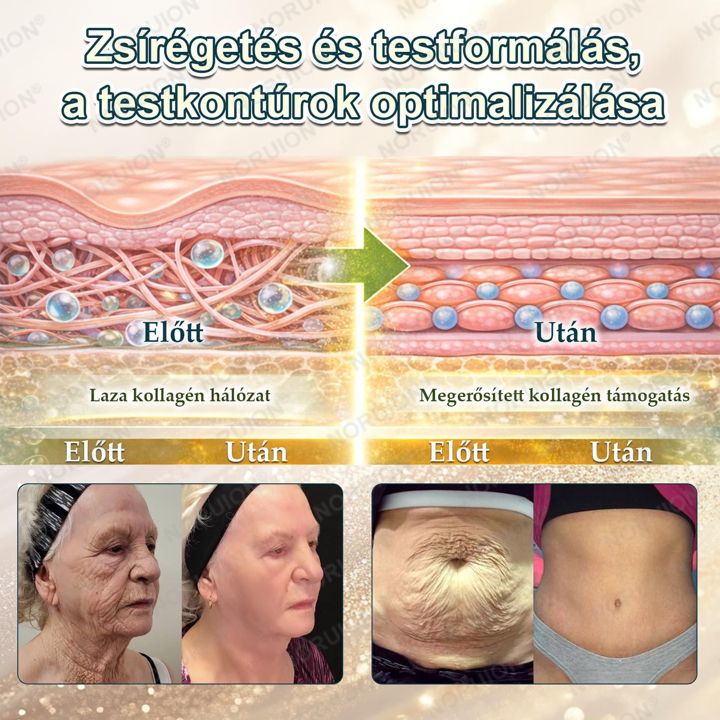 🎁 NORUION® AKG Sejtszintű Metabolikus Aktiváló Szérum 🎁